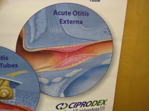 Acute Otitis Externa